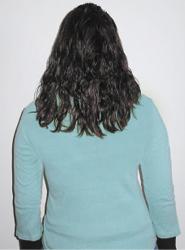 GrowFast Hair Revitalizer Before